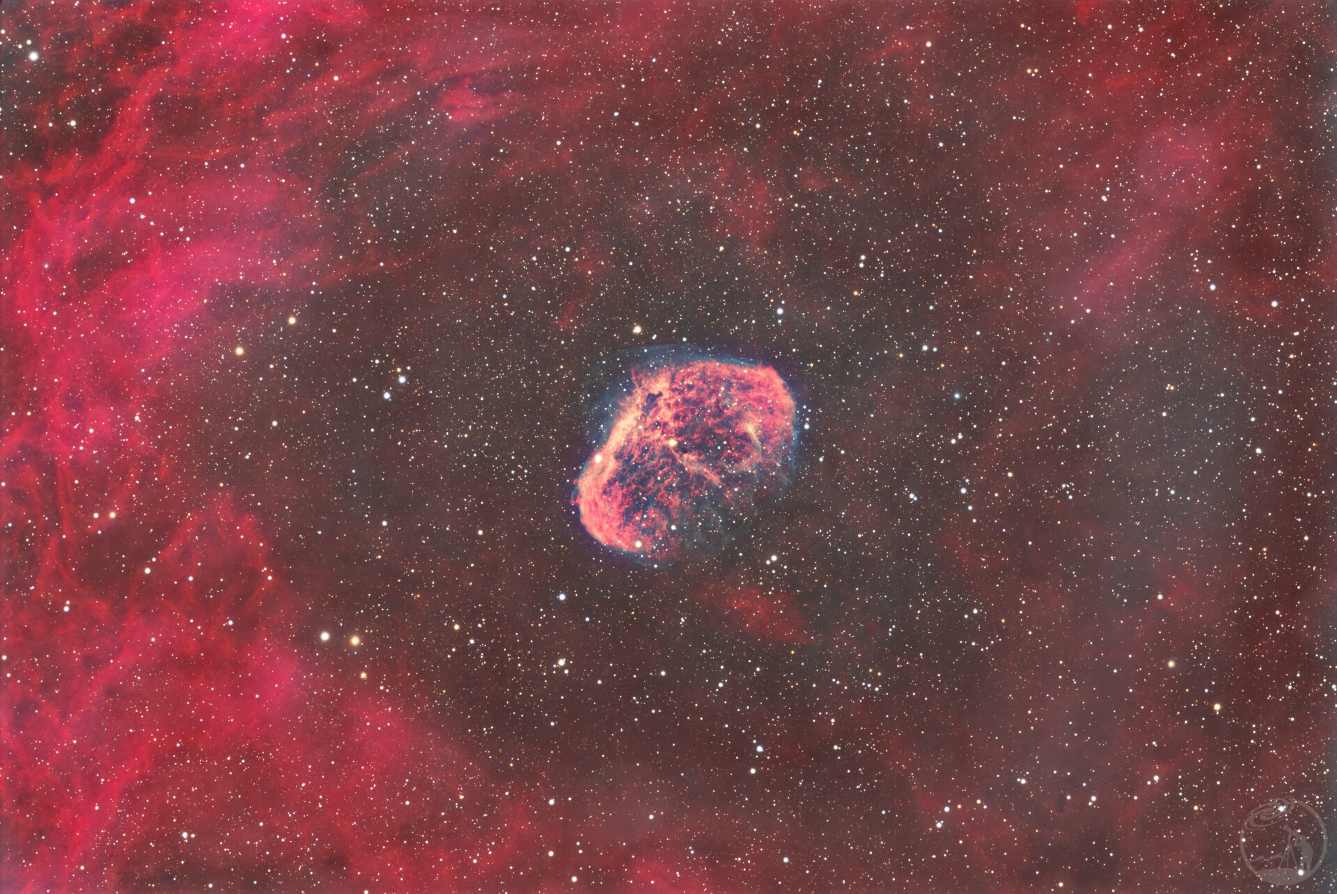 星眸第二弹——宇宙大脑花