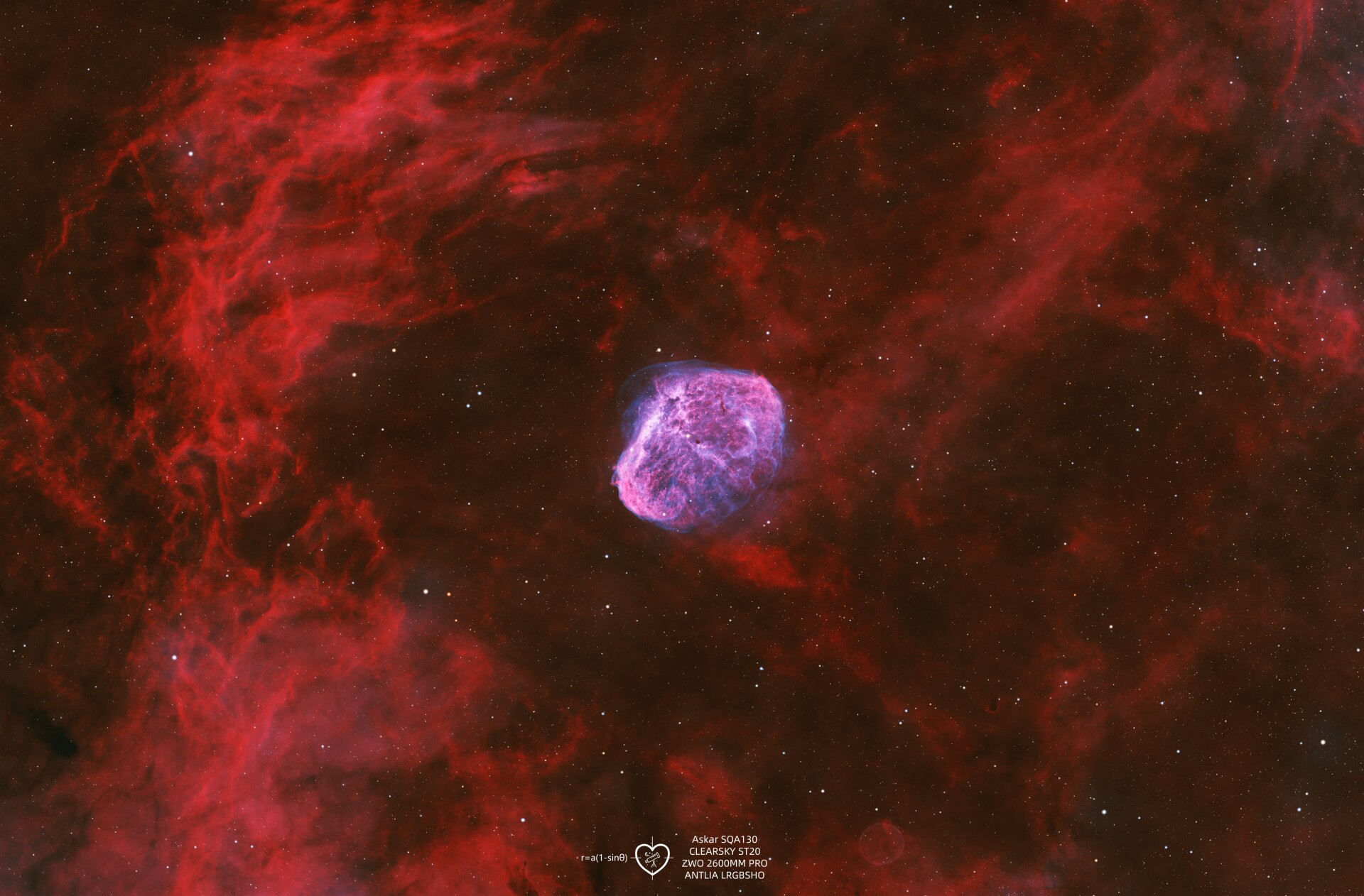 宇宙大脑