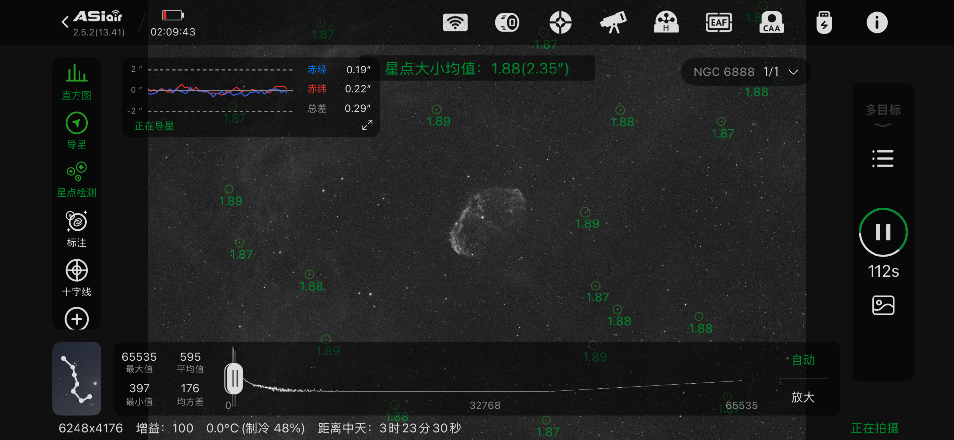 宇宙大脑