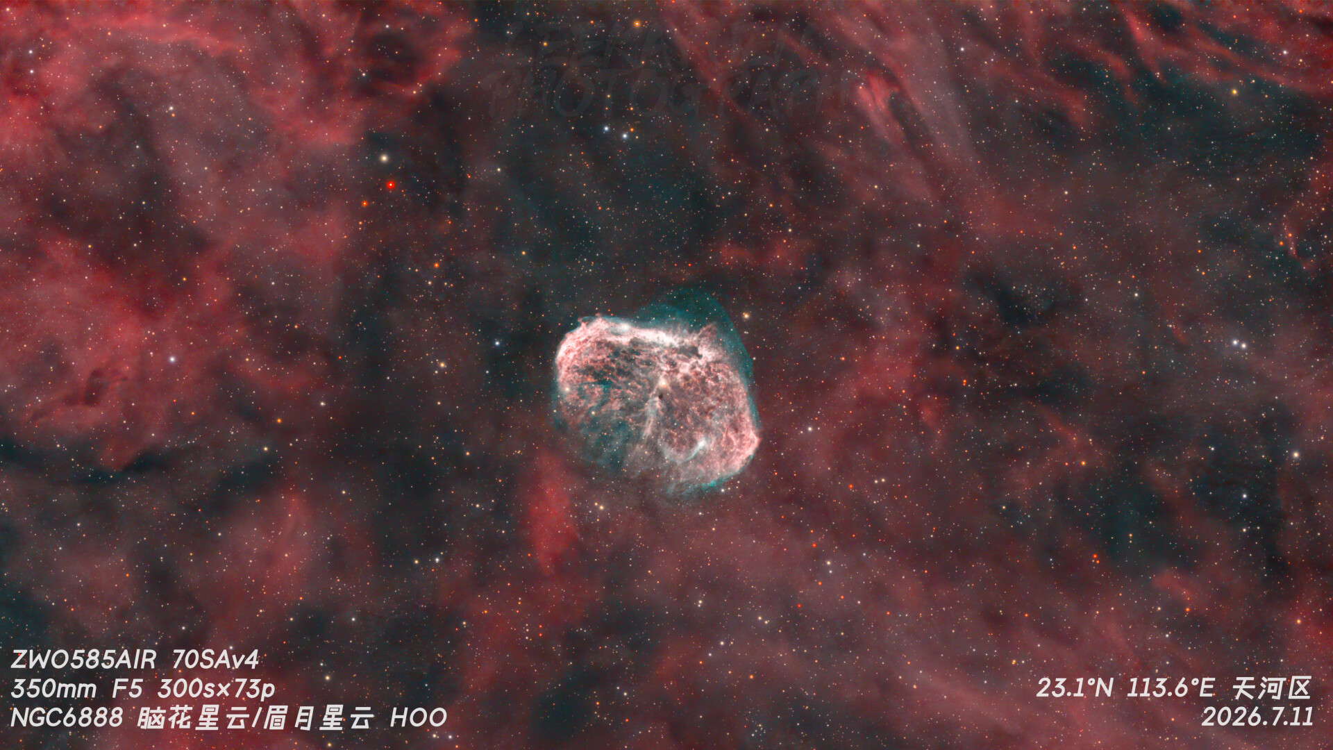 你这个脑花发霉了吧
